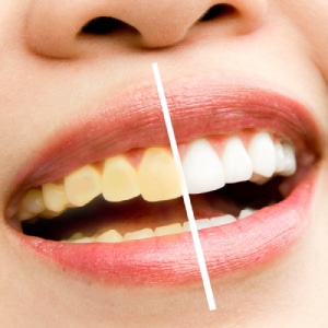 Cosmetic Dentistry 26